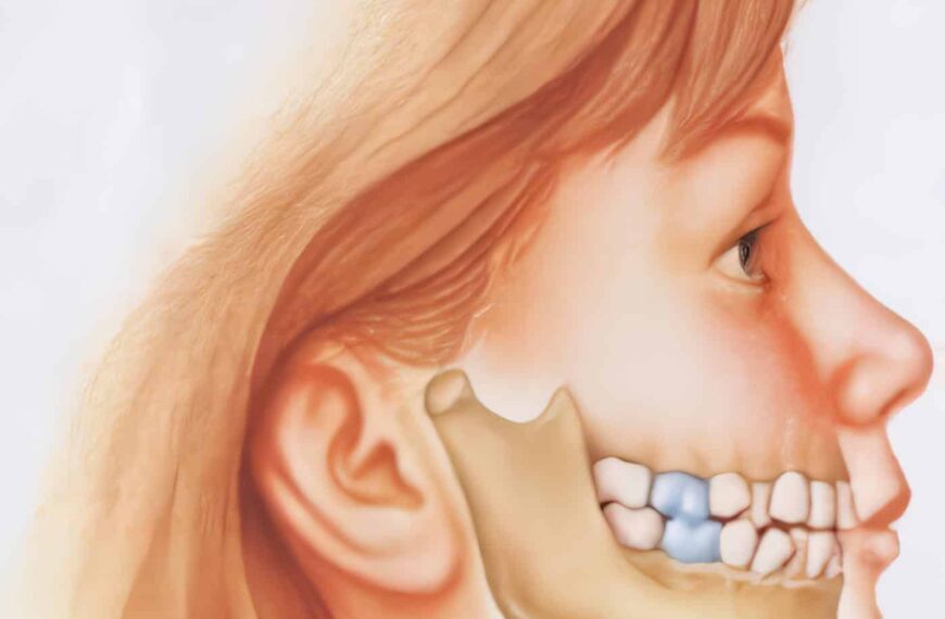 El Crecimiento Facial y Las Posibilidades Quirúrgicas