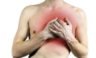 Enfermedad Cardíaca y el Accidente Cerebrovascular