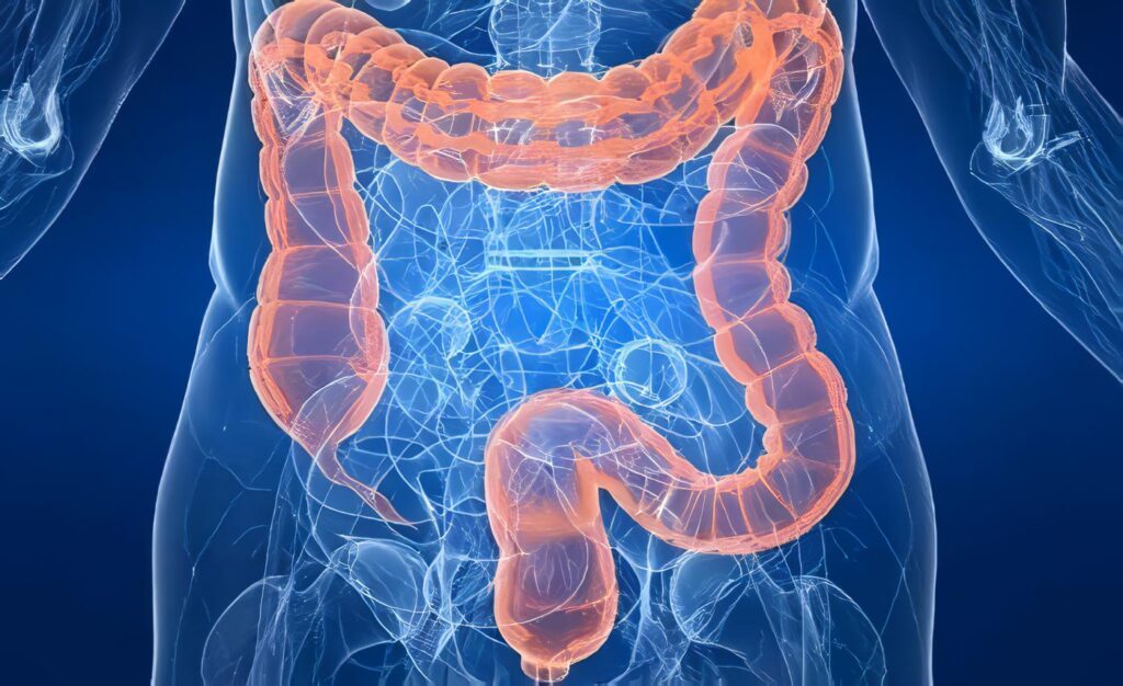 Enfermedad Intestinal Inflamatoria