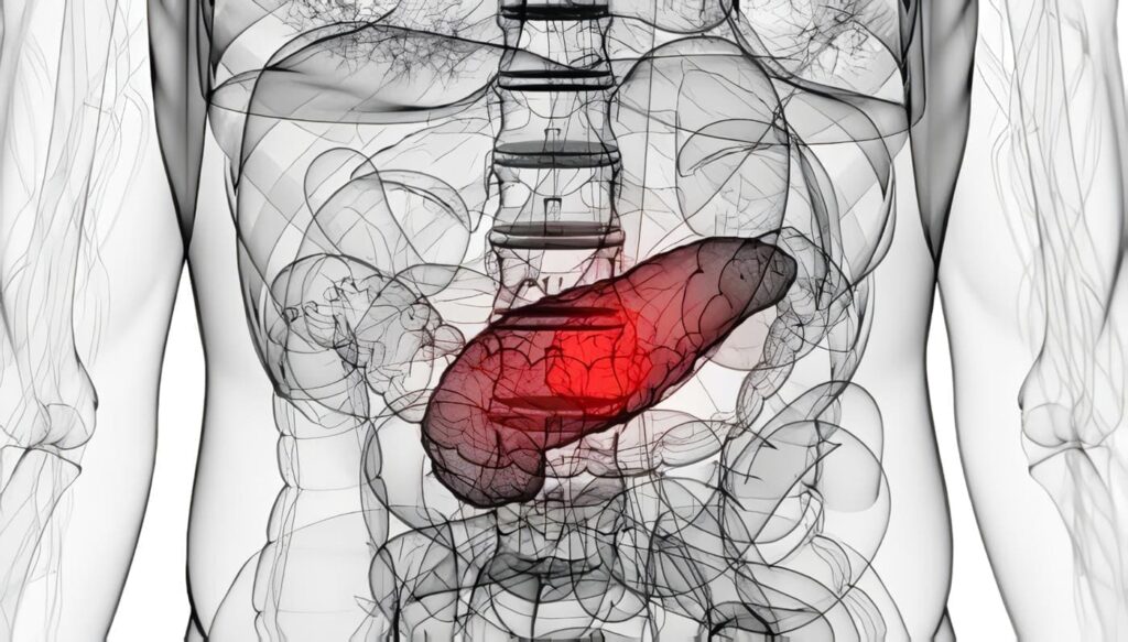 Flujo Sanguíneo en el Cáncer de Páncreas