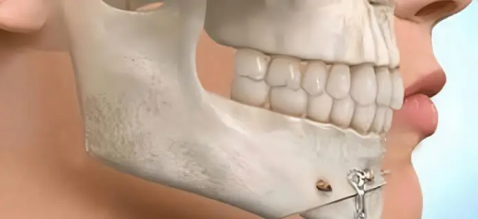 Historia de la Cirugía Oral y Maxilofacial