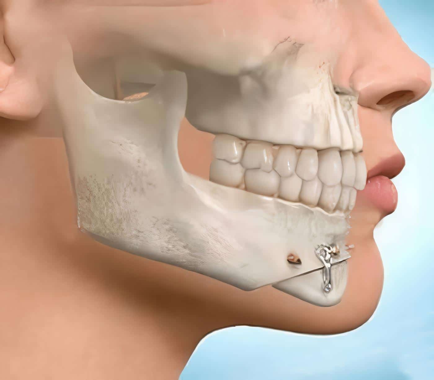 Historia de la Cirugía Oral y Maxilofacial