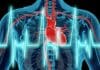 Medicamento usado en la Cirugía Cardíaca podría aumentar el riesgo de muerte