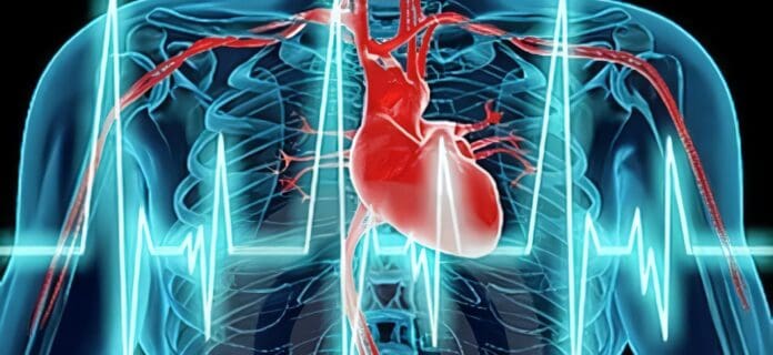 Medicamento usado en la Cirugía Cardíaca podría aumentar el riesgo de muerte