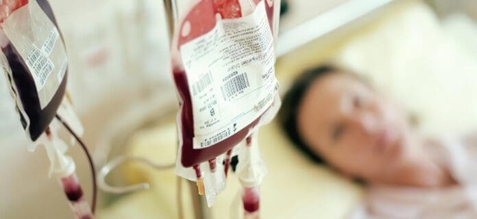 Transfusiones Frescas de Supervivencia