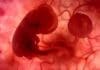 Relación entre la Epilepsia y la Infertilidad