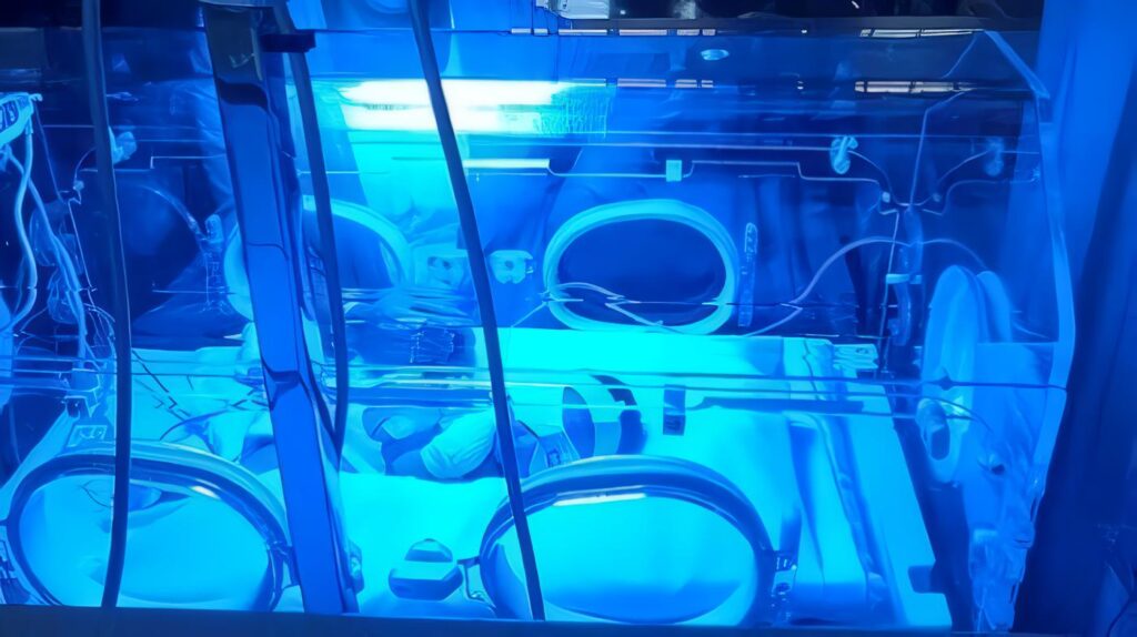 Incubadoras afectan el Ritmo Cardiaco