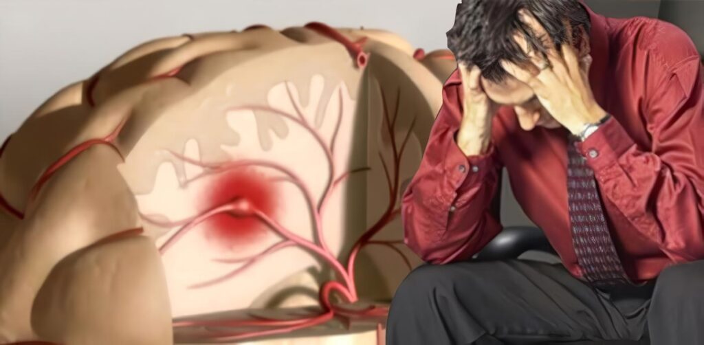 Insulina y Riesgo de Accidente Cerebrovascular