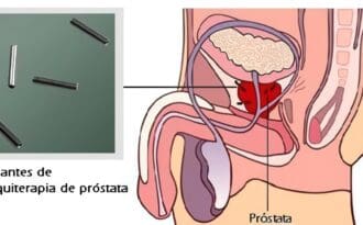 lista de medicamentos para la próstata