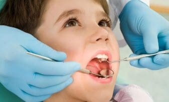 Niños pequeños con Caries