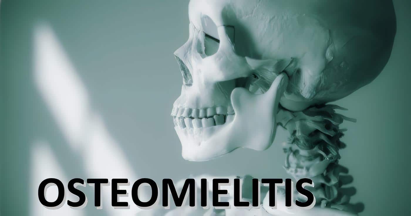 Cultivos en Osteomielitis