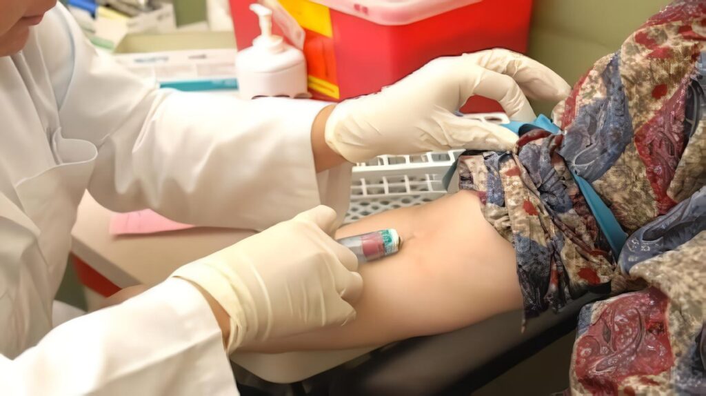 Prueba de Sangre para Cáncer de Pulmón