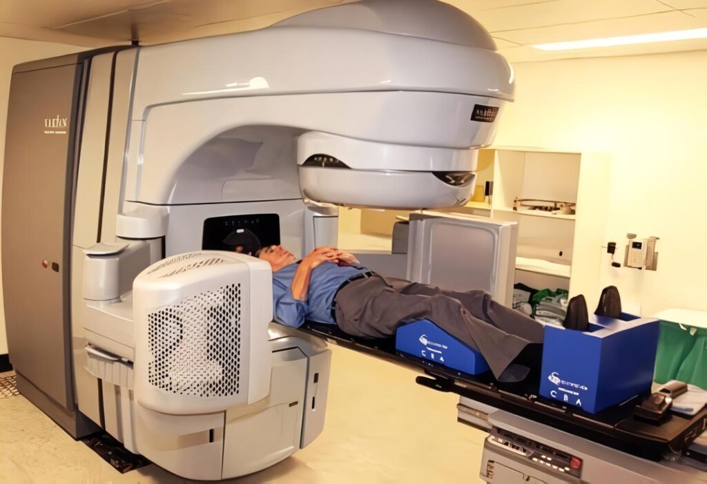 Radiación para Cáncer de Próstata