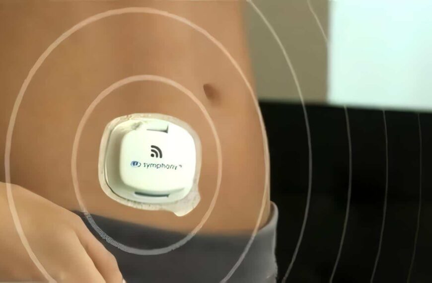 Sensor para Niveles de Glucemia