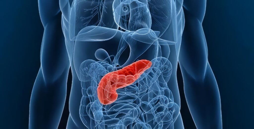 Cáncer de Páncreas