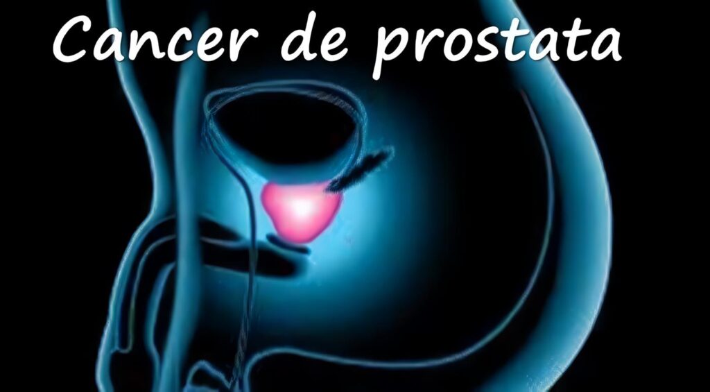 Cáncer de Próstata