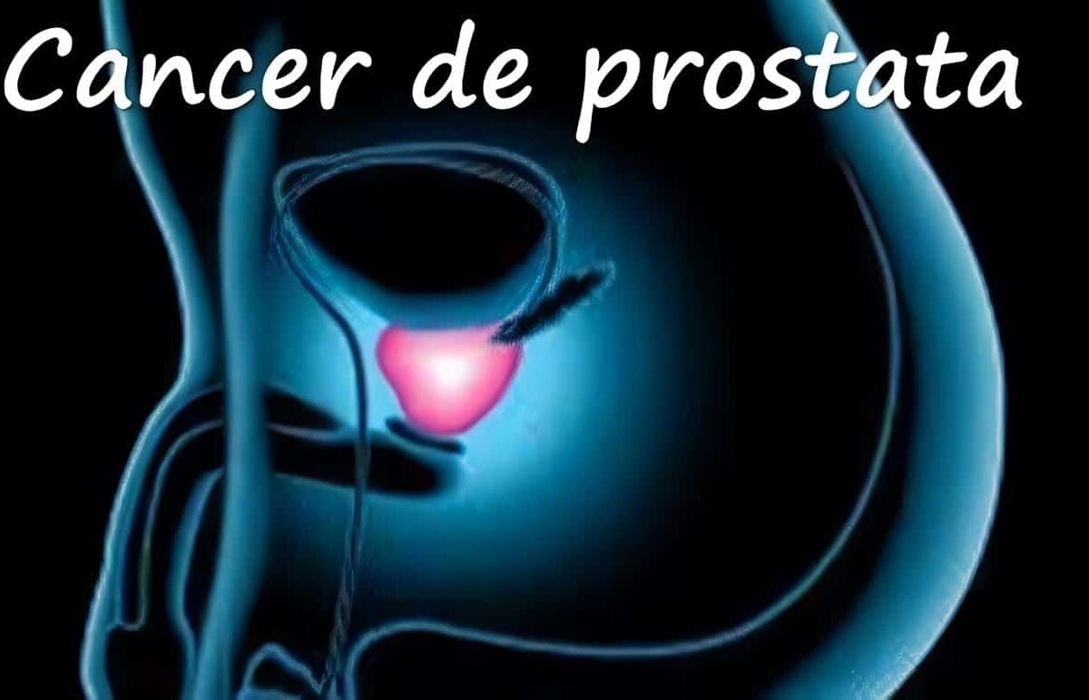 Cáncer de Próstata