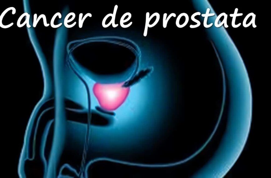 Cáncer de Próstata