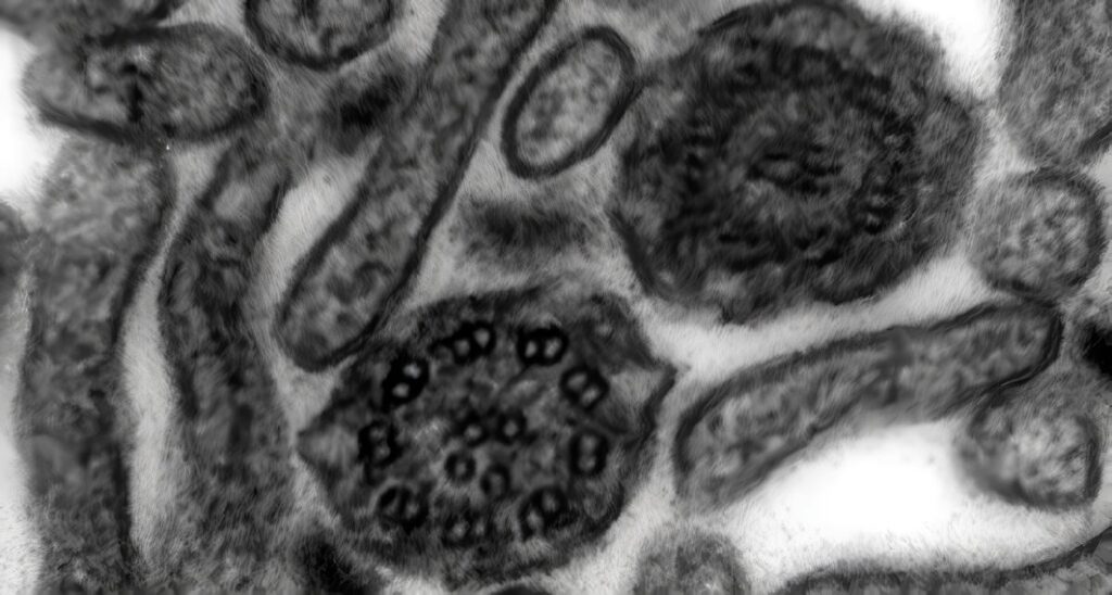 Autismo y la Cilia Primaria Neuronal