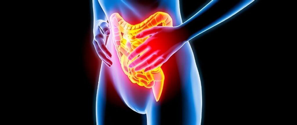 Terapia Conductual Calma el Colon Irritable