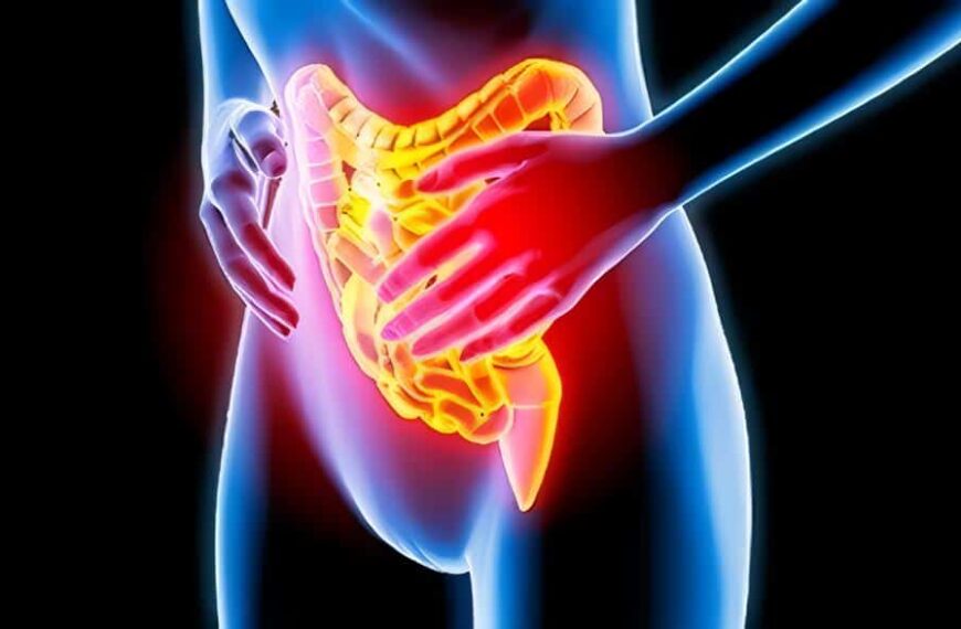 Terapia Conductual Calma el Colon Irritable