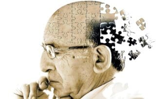 Demencia de Alzheimer