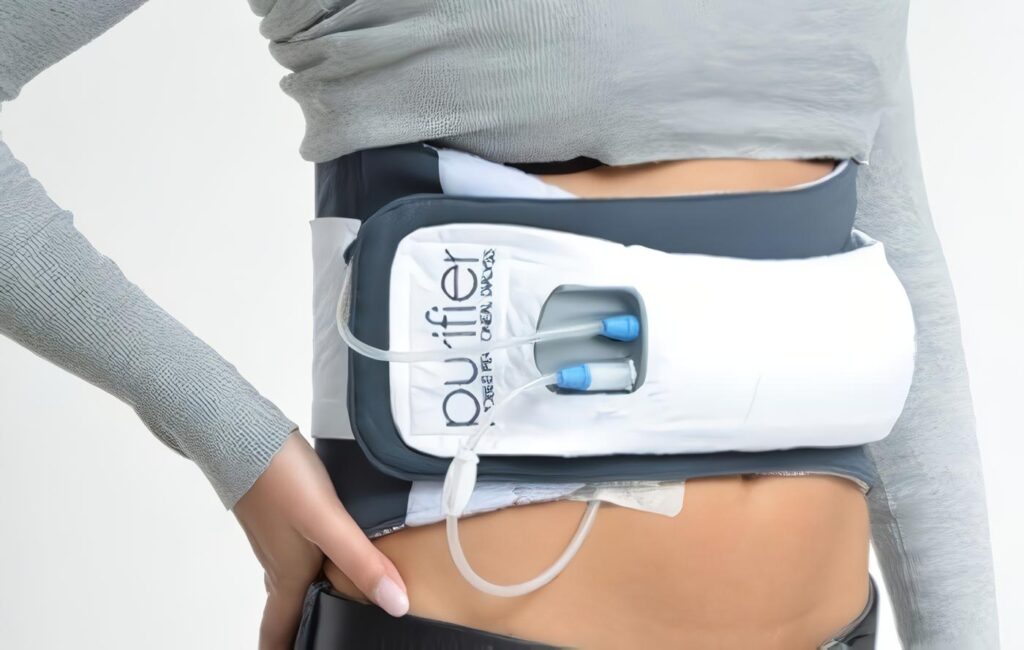 Diálisis Peritoneal