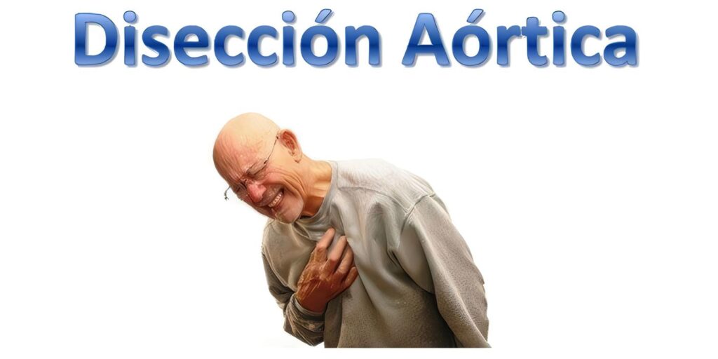 Disección Aórtica