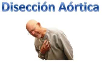 Disección Aórtica