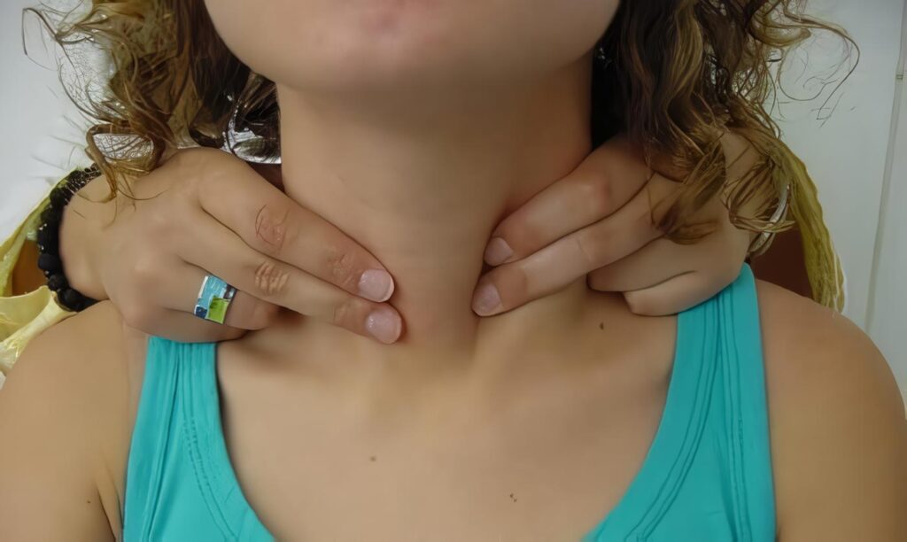 Disfunción Tiroidea y Enfermedad Cardiaca