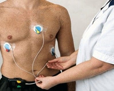 Dispositivo Implantable podría Reducir la Hipertensión