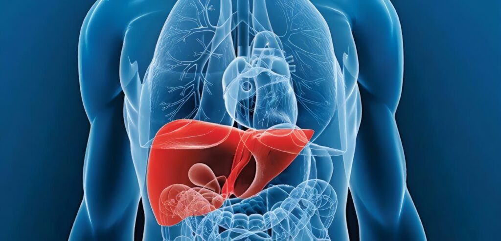 Enfermedad de Gaucher