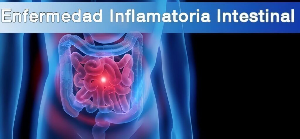 Enfermedad Inflamatoria Intestinal