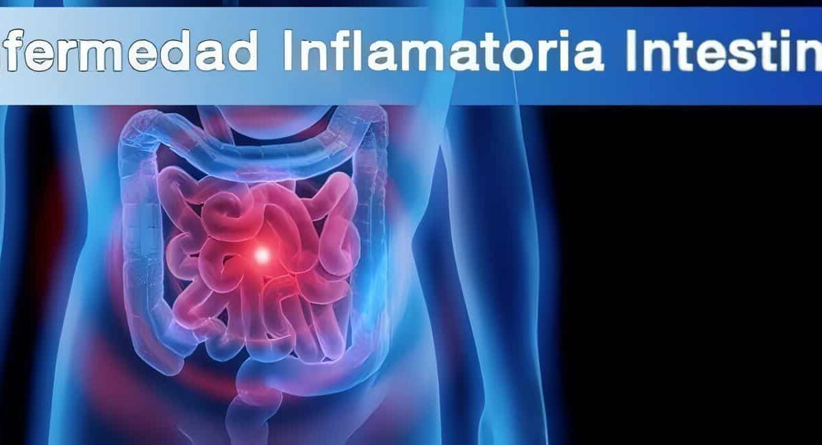 Enfermedad Inflamatoria Intestinal