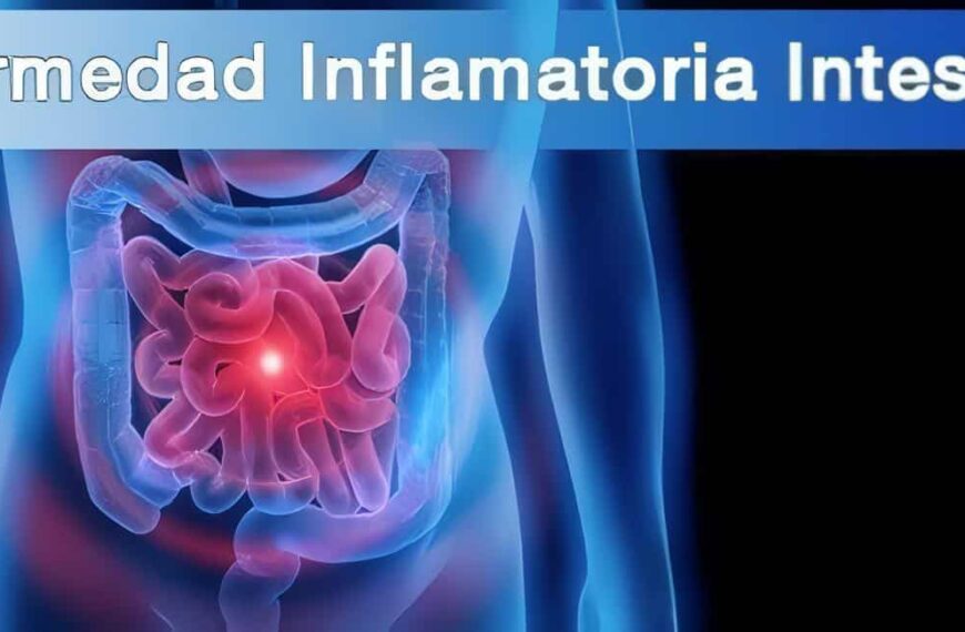 Enfermedad Inflamatoria Intestinal