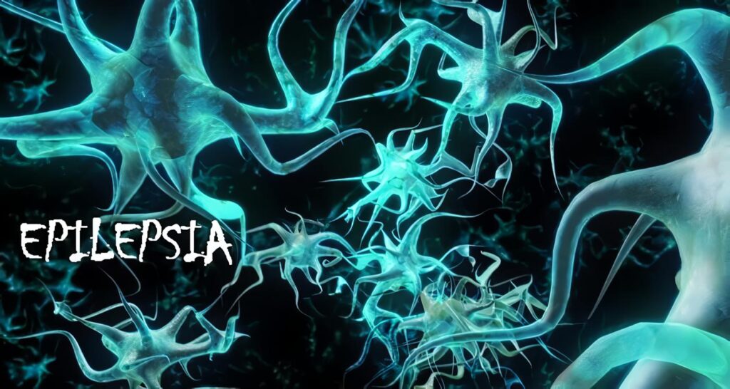Pregabalina Estudio de Bioequivalencia, Epilepsia