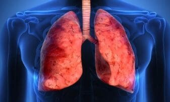 Función pulmonar en Revascularización