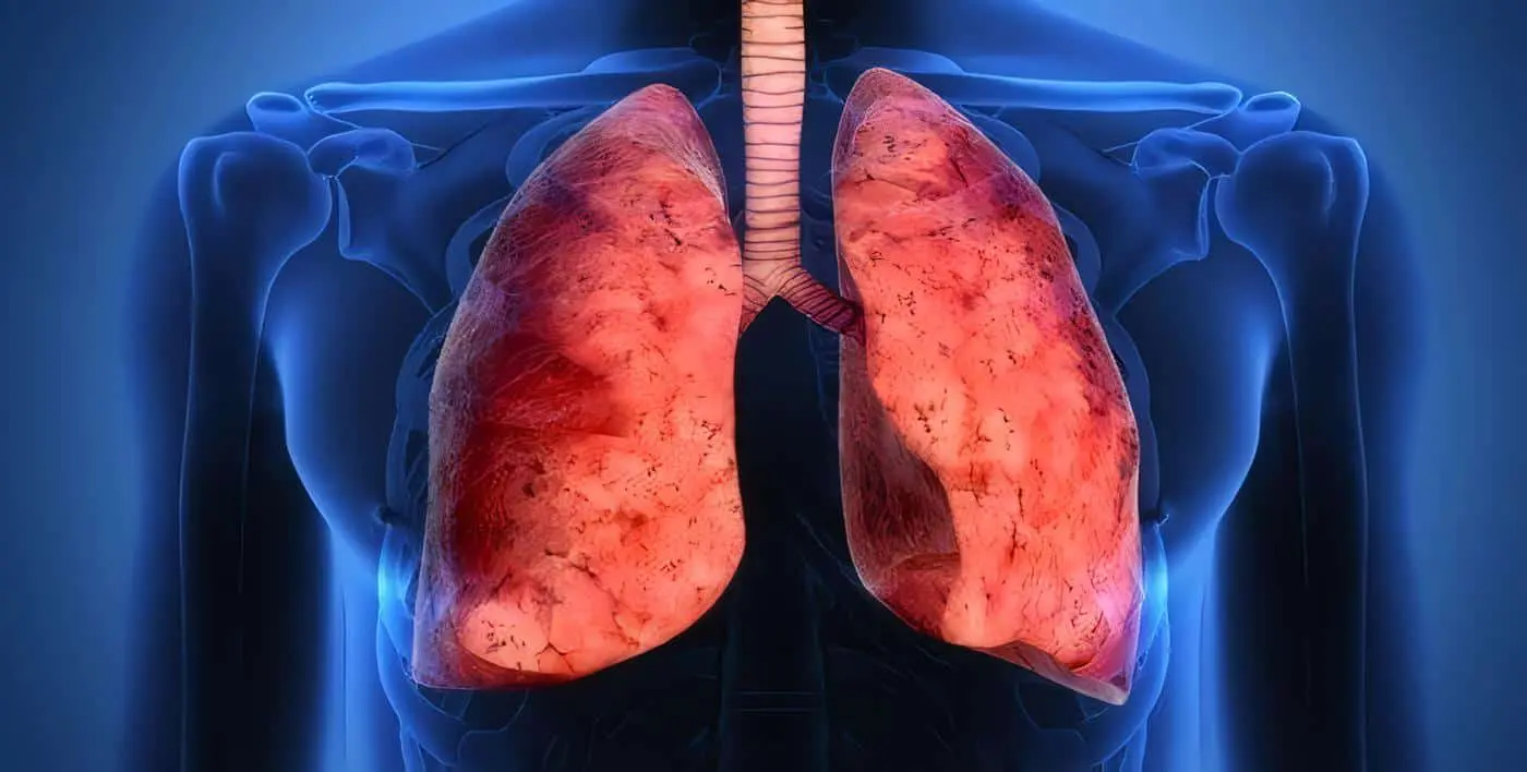 Función pulmonar en Revascularización