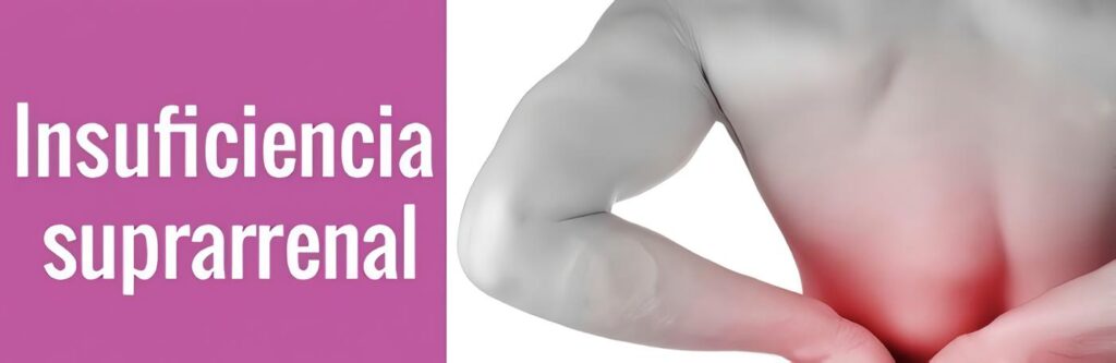 Insuficiencia Suprarrenal