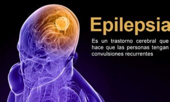 Libro sobre Epilepsia