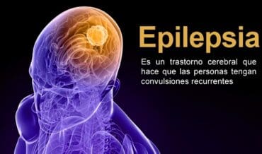 Libro sobre Epilepsia