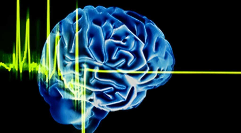 Muerte Cerebral