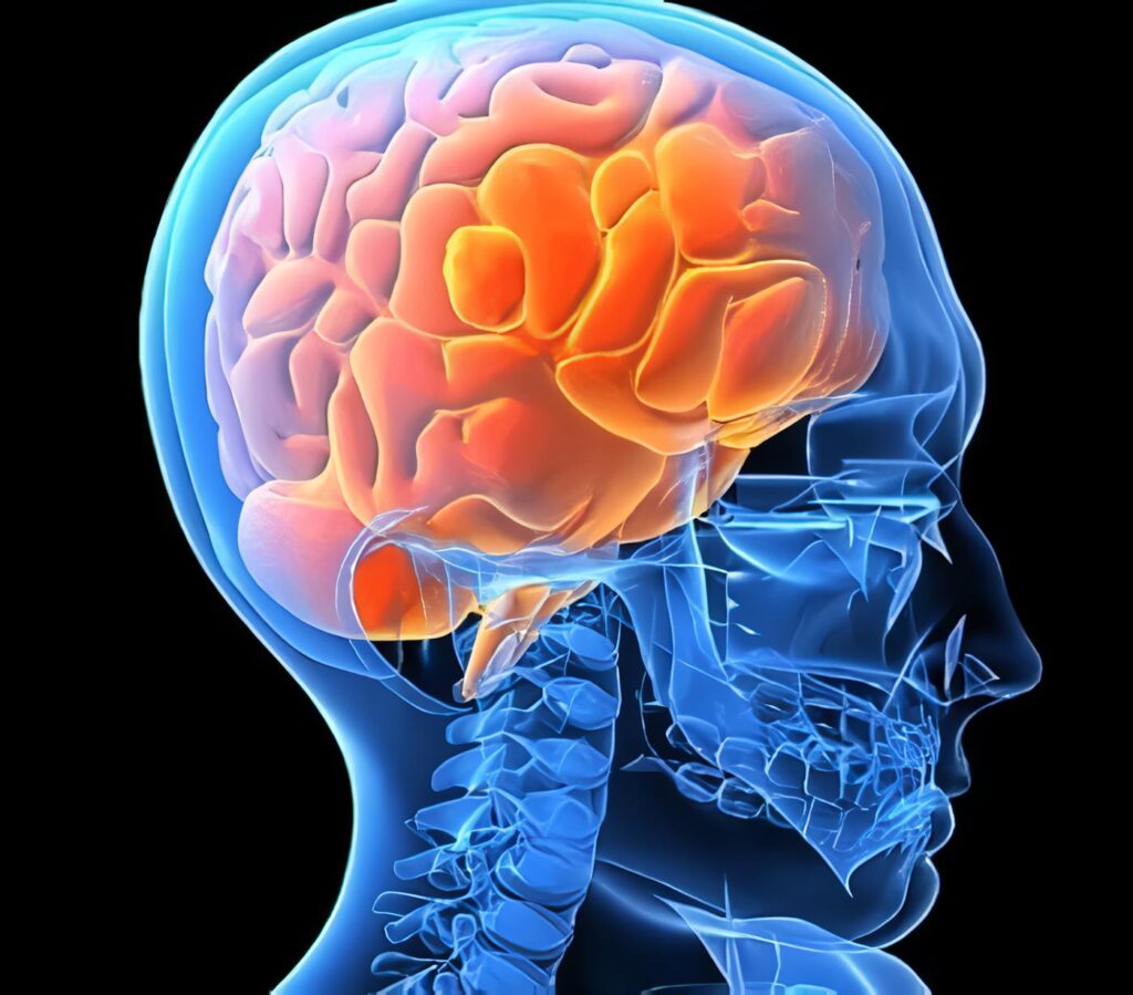 Neuroepidemiología en el Departamento de Caldas