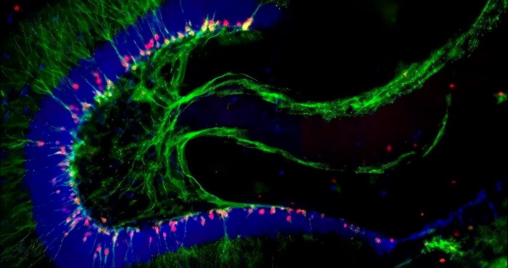 Plasticidad y Neurogénesis