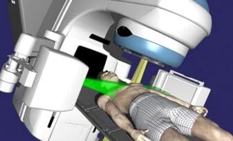 Radioterapia y Crecimiento