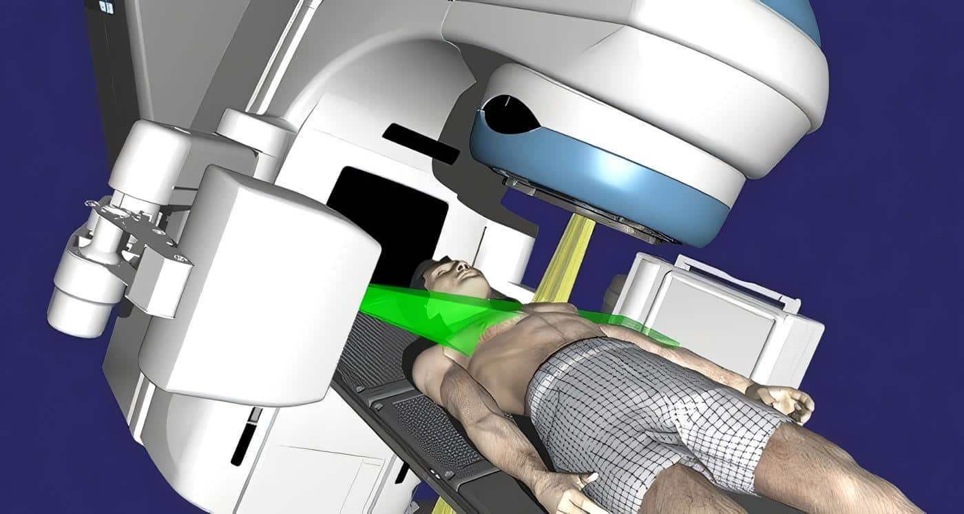 Radioterapia y Crecimiento