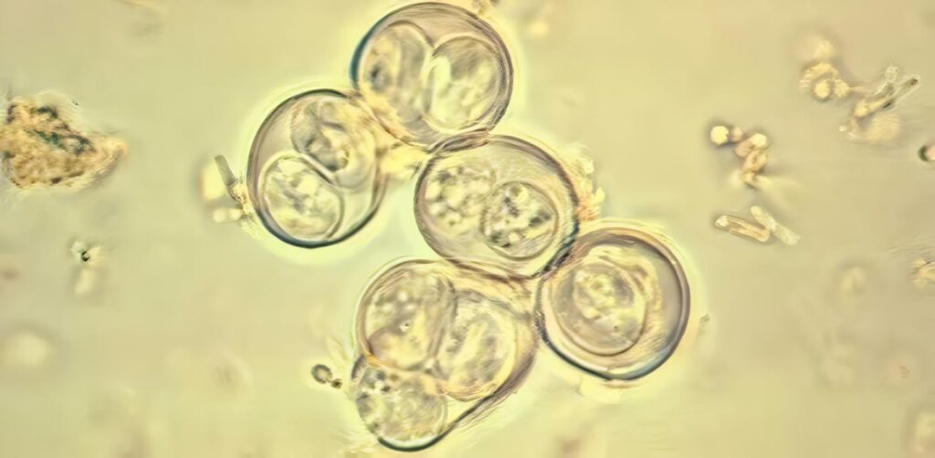 Predominio de Toxoplasma SAG2 Tipo 1 Circulante
