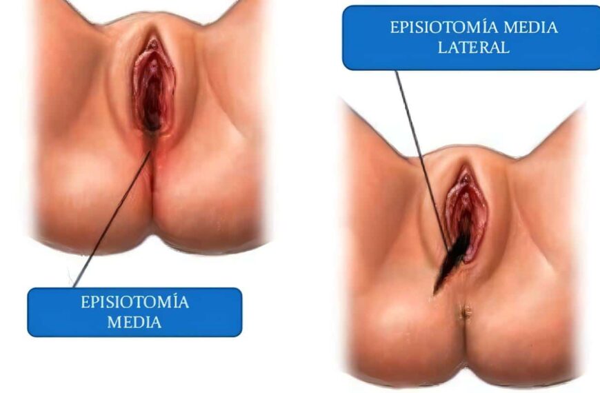 Traumas Pasados en Trastorno Intestinal