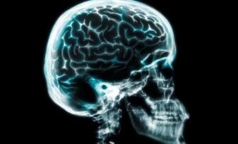 Tratamiento para el Glioblastoma