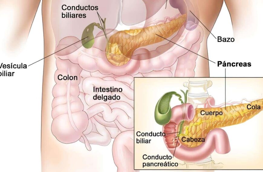 Tumores Neuroendocrinos Pancreáticos